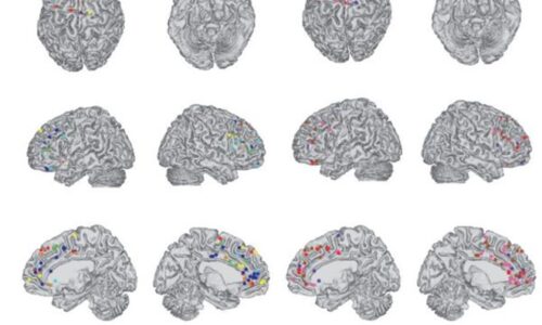 Métodos de diagnóstico por imagen en el cerebro del adicto