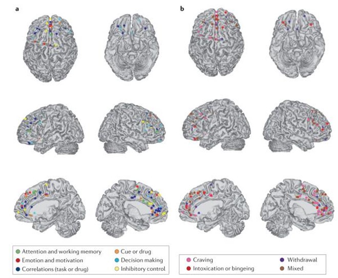 Métodos de diagnóstico por imagen en el cerebro del adicto