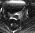 Figura 9