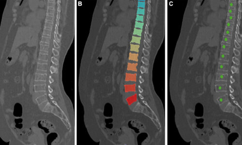 Opportunistic CT Screening: Clinical Applications, Technical Foundations, and Best Practices Opportunistic CT Screening: Clinical Applications, Technical Foundations, and Best Practices